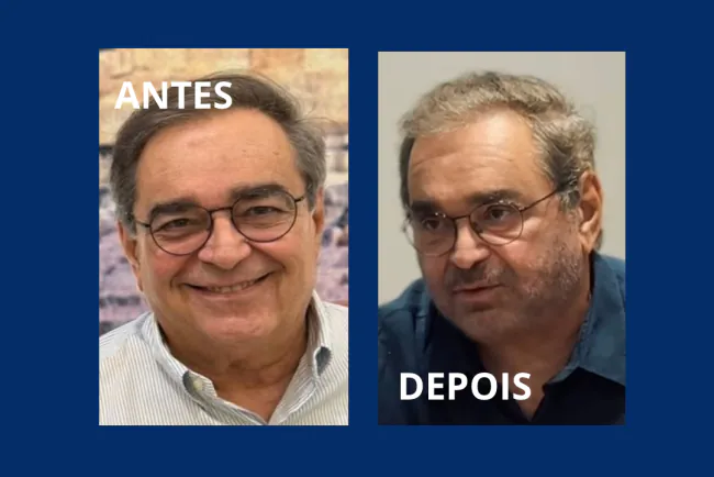 REJUVENESCIDO: Álvaro volta aos holofotes após procedimentos estéticos